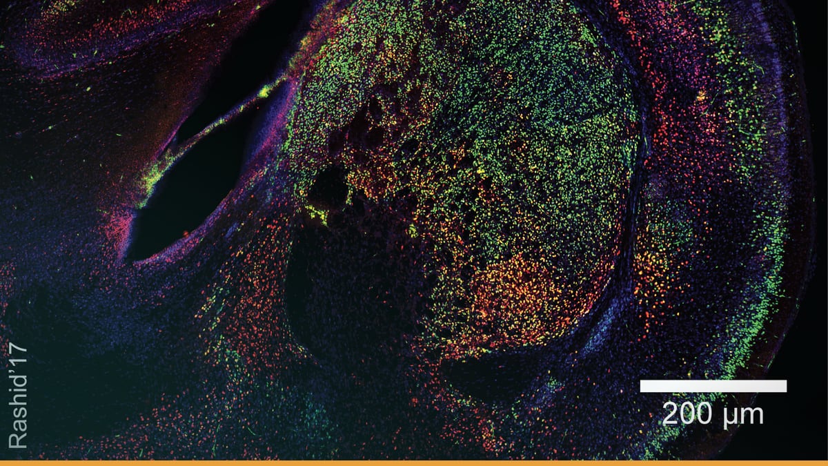 Meet a mouse whose brain cortex is made up of human cells — human mouse brain experiment